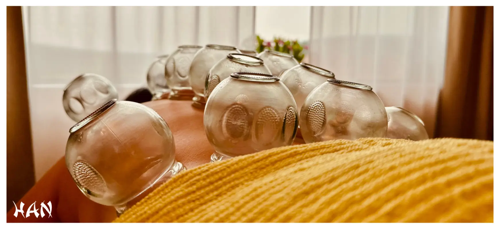 Schröpfmassage